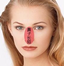 鼻子上冒痘怎么办 五个小妙招帮你轻松祛痘