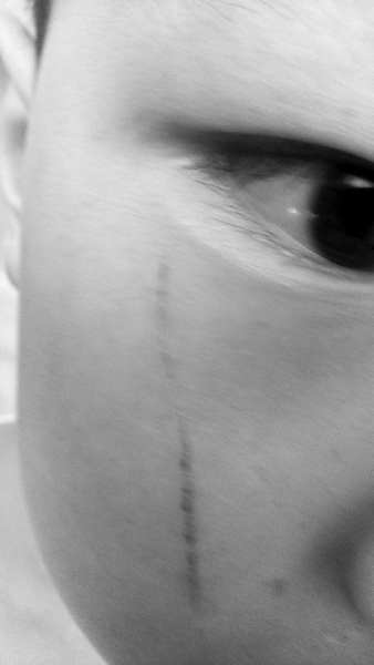 安阳7岁男童因忘带子表遭老师书包“砸头”