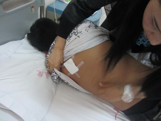 被刺伤的张博躺在病床上