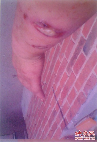 新野中年妇女血战藏獒20分钟救下4岁男童