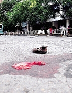 老人被送往医院,事发现场留下老人的鞋袜和一摊血迹