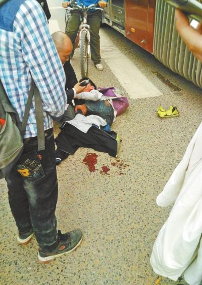 郑州10岁男孩等红灯太靠近BRT道 被公交撞骨折 