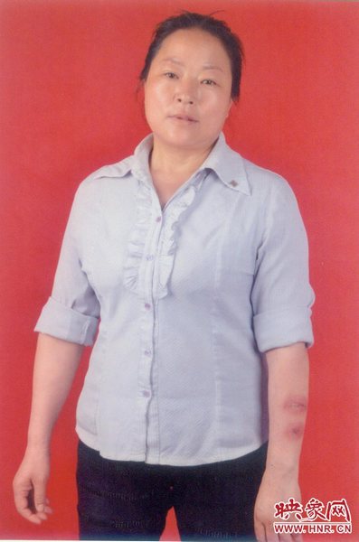 新野中年妇女血战藏獒20分钟救下4岁男童