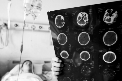 郑州市一小伙被撞,肇事车逃逸,药费成了难题。